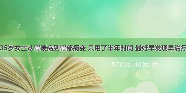 35岁女士从胃溃疡到胃部病变 只用了半年时间 最好早发现早治疗