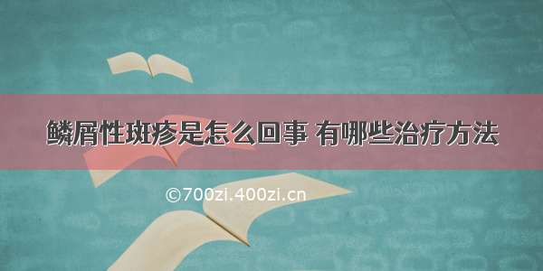 鳞屑性斑疹是怎么回事 有哪些治疗方法