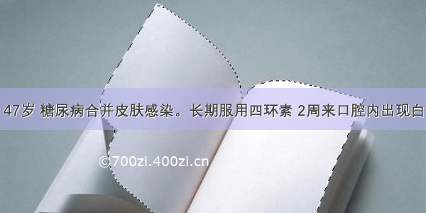 男性患者 47岁 糖尿病合并皮肤感染。长期服用四环素 2周来口腔内出现白色薄膜 消