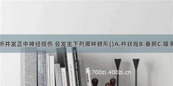 肱骨髁上骨折并发正中神经损伤 会发生下列哪种畸形()A.杵状指B.垂腕C.猿手畸形D.银叉