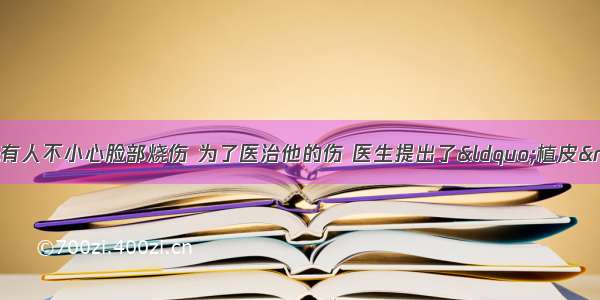 一题科学题.快噢.有人不小心脸部烧伤 为了医治他的伤 医生提出了&ldquo;植皮&rdquo;手术疗法.